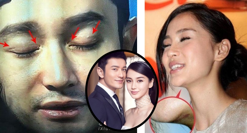 惊!明星不承认整容,这些疤痕怎么解释?但最后一 ...