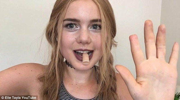 16歲金發少女「罹患厭食症」只剩23公斤「手指也被截肢」，康復後的模樣卻讓網友爽叫「沒手指也可以」！