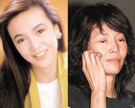 整容過度老了就 這些女星原本都美到不行 但是現在