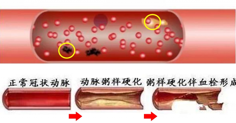 图片来源 图片来源 有些人的血管不免让人捏一把汗,就像家中的自来水