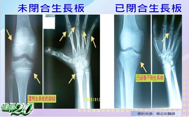 孩子長高的 黃金時期 在這個時間點 這些 運動 與 食物 幫