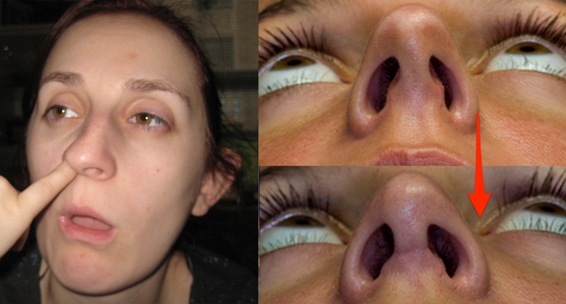 Life生活網 太恐怖了 這就是常 挖鼻孔 的下場 竟然比我想像的還可怕100倍啊