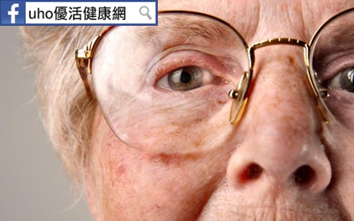 50歲以上中老年人常見眼疾為「黃斑部病變」，如何治療？