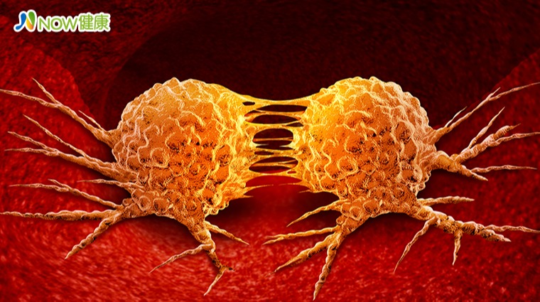 三軍總醫院研發CAR-T細胞治療 造福淋巴癌及血癌患者