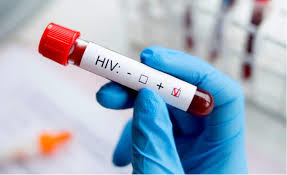 愛滋病檢查p24 抗原測試
