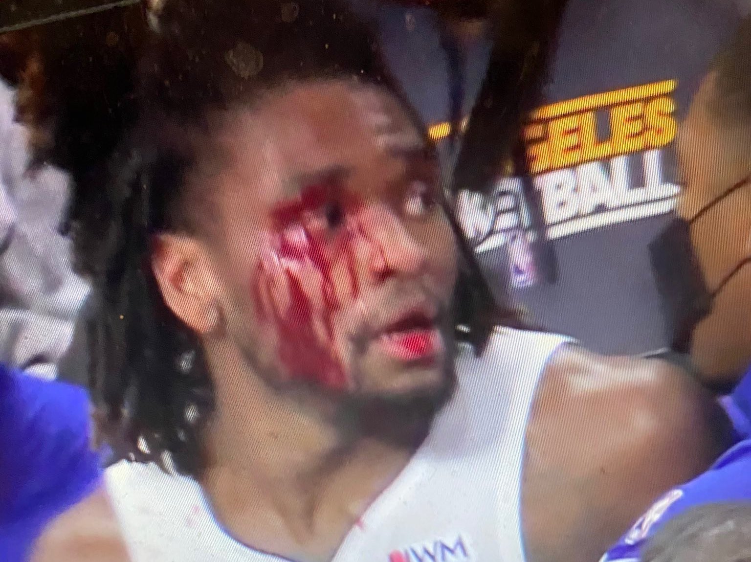 影／NBA流血暴力！詹姆斯卡位爆激烈衝突　賽後拒絕受訪